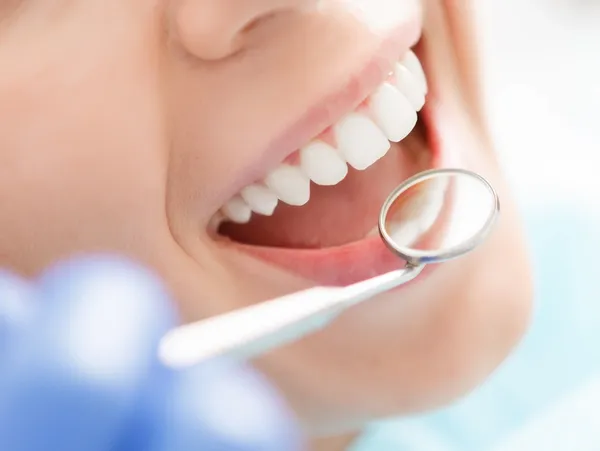 Check-Up and Cleans-Preventative Care in Mooroolbark