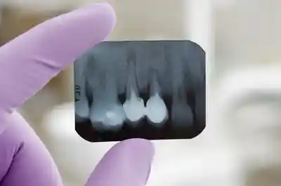 Dental x-rays, including panoramic (OPG) and bitewings